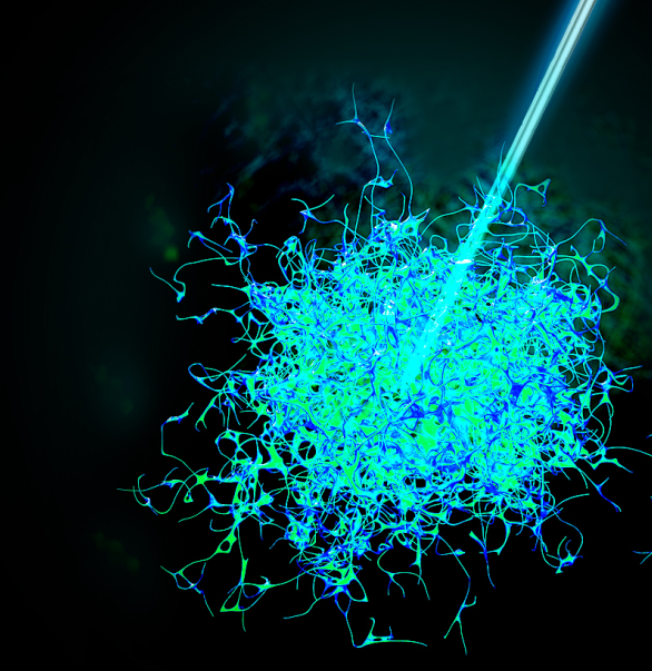 今天，我們把腫瘤的內部「融穿」了