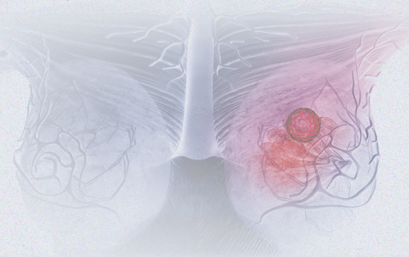 國際婦女節 | 關注乳腺癌 微創介入讓美麗繼續，「乳」愿以償正成為現實