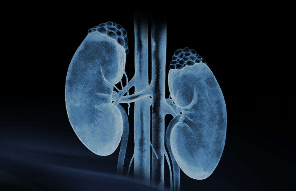 世界腎臟日 | 相得「腎」歡，融有術、精準適形