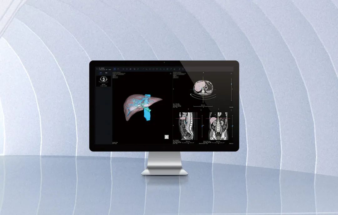 北京市首款！海杰亞醫(yī)療自主研發(fā)的AI+肝臟CT影像處理軟件獲批上市！